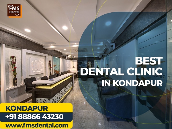 FMS Dental Clinic Kondapur - Best Dental implant clinic in Kondapur