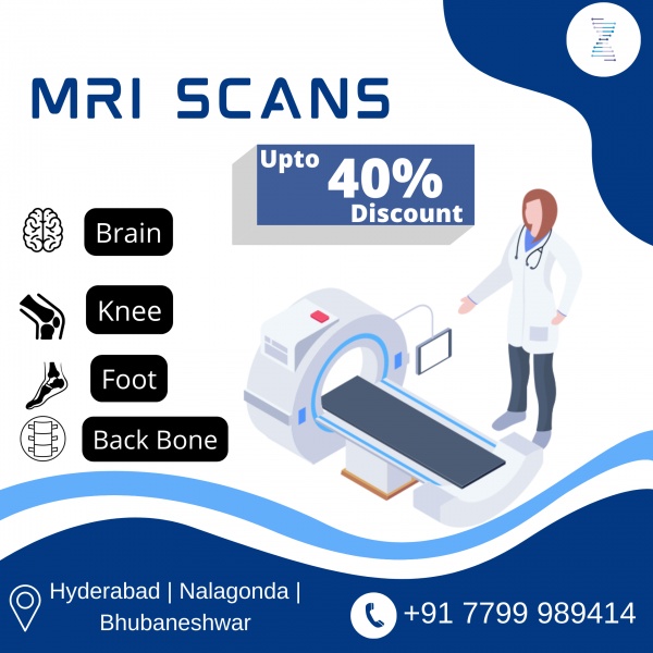 MRI Scan Cost in Hyderabad | Safe Hands Diagnostics